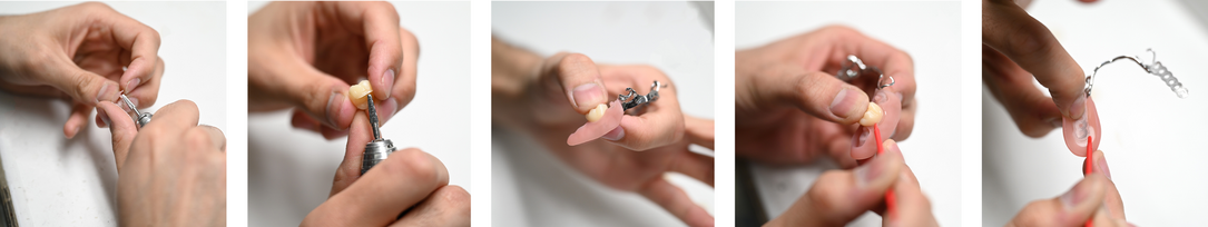 ModularDenture by CADdent®